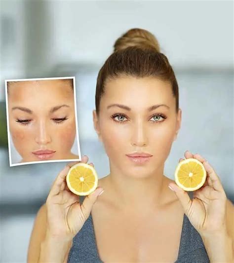 How To Use Lemon Juice For Dark Spots On Face 9 Natural Ways Dark