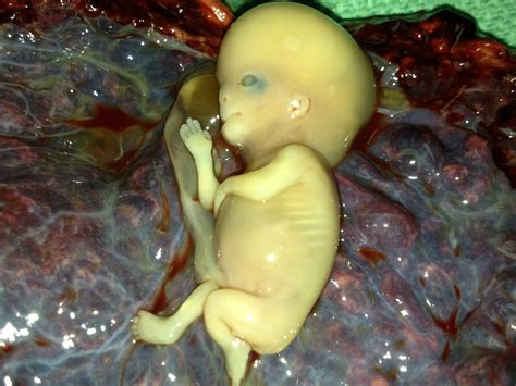 By halfway through a healthy pregnancy, it's about 15 centimetres in diameter (the size of a side plate), and by the end it doubles to become about the size of a frisbee and the weight of a block and a half of butter. ParadoxUganda: Fearfully and Wonderfully Made