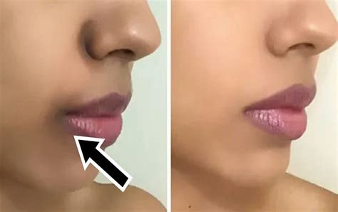 كيف ازيل السواد حول الفم