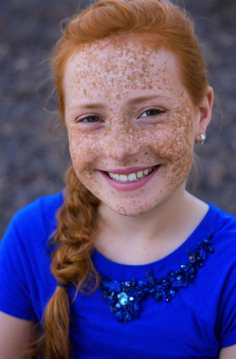 freckle face by fr3ckl3luv3r on deviantart