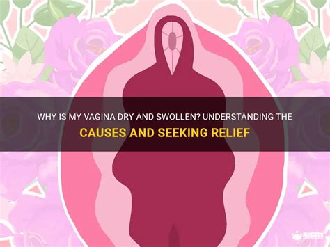 Why Is My Vagina Dry And Swollen Understanding The Causes And Seeking