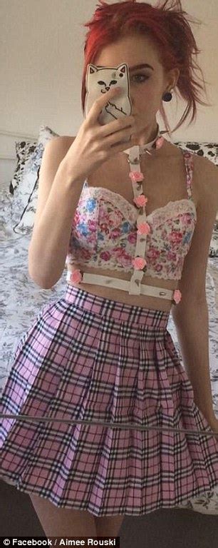 Aimee Rouski With Crohn S Disease Posts A Brave Selfie Of Her Ileostomy Bag Daily Mail Online