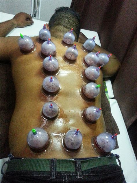 Lelaki dan wanita, semua berpotensi untuk membongkok adalah posisi tubuh yang buruk bagi badan anda. Point bekam di pinggang dan belakang - Pusat Bekam Bangi