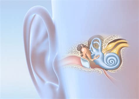 Hidden Hearing Loss: A 10-Year Journey - FOCUS - A health ...