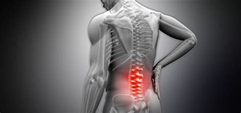 Collapsed Spinal Vertebrae Causes And Treatments