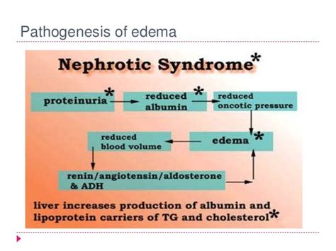 Nephrotic Syndrome