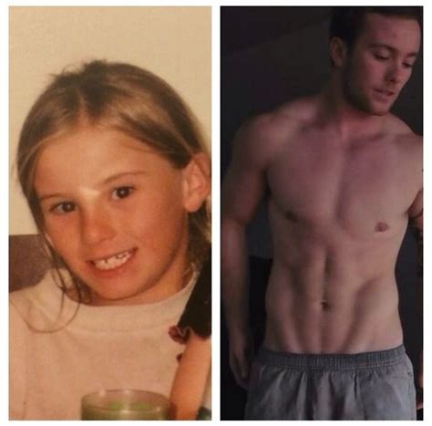 List 90 Pictures Male To Female Transition Surgery Pictures Stunning