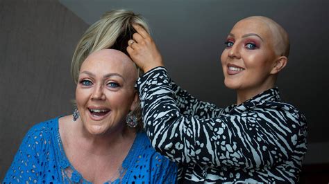 Alopecia ‘i Couldnt Bear The Thought Of Her Losing Her Hair The Irish Times