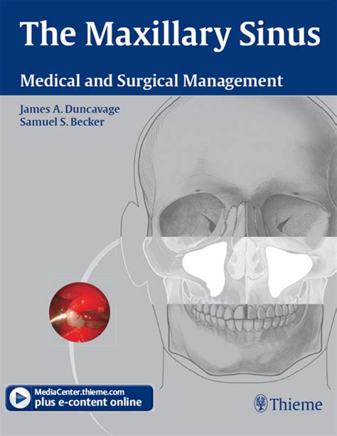 Solution The Maxillary Sinus Medical And Surgical Management Studypool