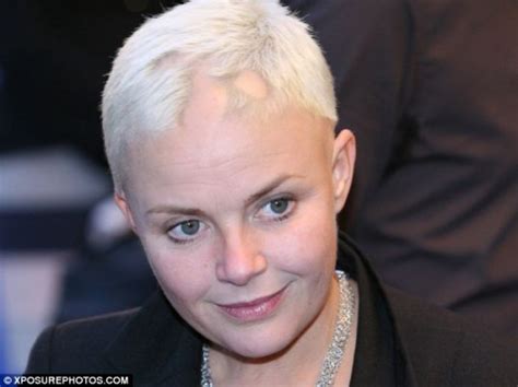 Gail Porter Shows New Hair Recovery As Alopecia Appears To Recede
