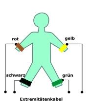 Diese sind besonders interessant, weil sie unmittelbar den schlüssel zum verständnis einer symptomatik oder erkrankung liefern können. Wie schreibe ich ein EKG
