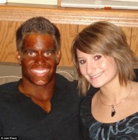 Funny Pictures Show The Most Epic Tan Fails From Sunbeds Daily Mail