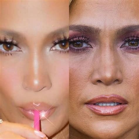 Plastic Surgeon Reveals Before And After Celebrity Photos Demotix
