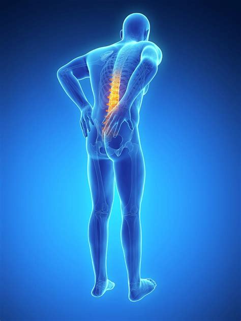Human Back Pain Photograph By Sebastian Kaulitzki Fine Art America