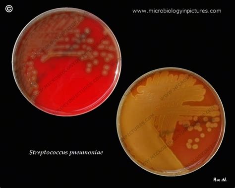 Virulent And Avirulent Forms Of Streptococcus Pneumoniae Appearance Of
