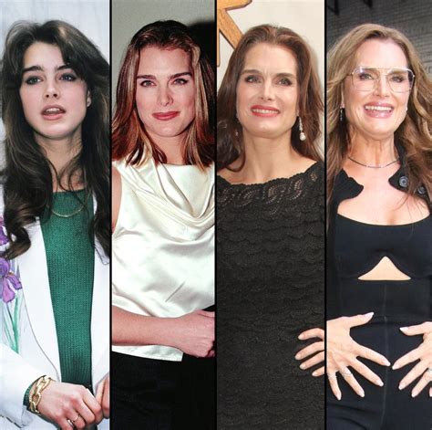 Has Brooke Shields Had Plastic Surgery Her Transformation Over The