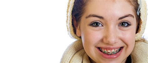 Another sign that you might need braces is difficulty with eating, chewing, or swallowing. 12 Things You Should Know Before Getting Braces - Biermann ...