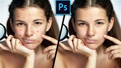 How To Remove Acne From Your Face In Photoshop Youtube