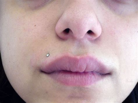 By taking valtrex, would this make it go away on my face? Top 10 Misconceptions About How Herpes Manifests And Can ...