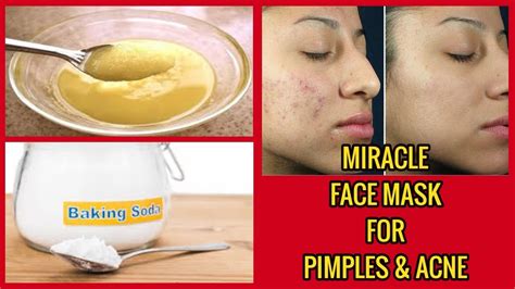 Miracle Face Mask For Pimples And Acne Baking Soda Honey Olive Oil Mask
