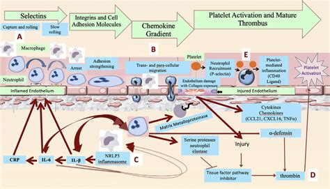 Proposed Pathophysiology Of Acute Vascular Inflammation In Sars Cov 2