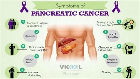 The nausea comes only after i eat. 10 Early symptoms of pancreatic cancer in humans