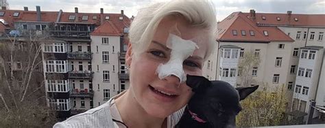 2014 krallt sie sich schließlich selbst die. Nach Beauty-OP: So geschwollen ist Melanie Müllers Gesicht ...