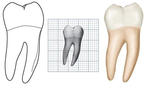 The Permanent Mandibular Molars Dental Anatomy Physiology And