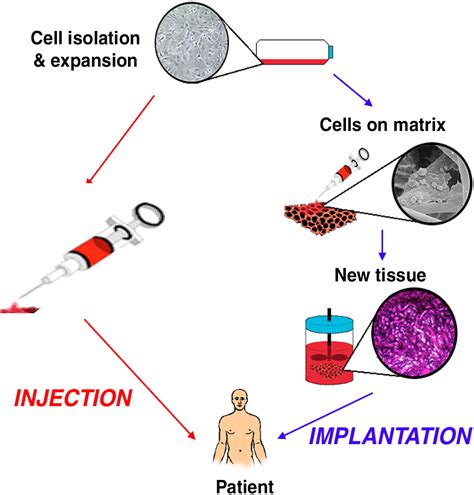 Cell Delivery Mechanisms For Tissue Repair Cell Stem Cell