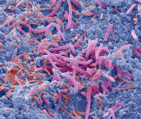 How common is bacterial vaginosis? Tongue bacteria, SEM - Stock Image - F012/8938 - Science ...