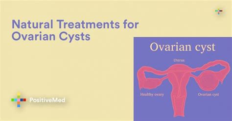 Natural Treatments For Ovarian Cysts