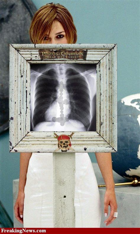 Celebrities Under X Rays Pics