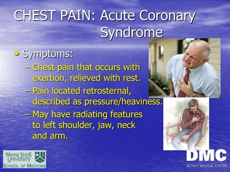 Ppt Chest Pain Powerpoint Presentation Free Download Id3473696