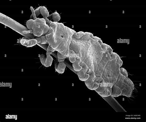 Head Louse Scanning Electron Micrograph Sem Of The Head And Thorax