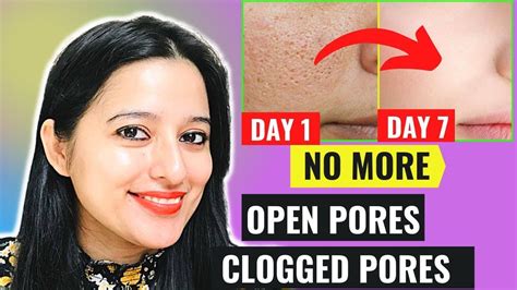 Open Pores और Clogged Pores को Remove करें इस Remedy से सिर्फ 7 Days
