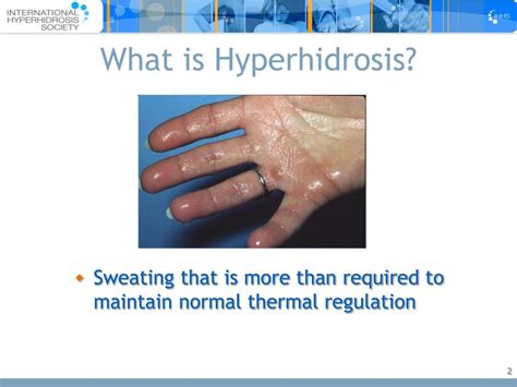 Ppt Hyperhidrosis Powerpoint Presentation Free Download Id22784