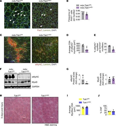 Jci Insight Targeted Regulation Of Tak1 Counteracts Dystrophinopathy