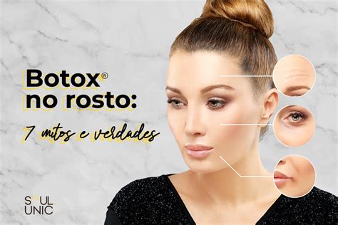 Botox No Rosto Mitos E Verdades Sobre A Aplica O De Toxina Botul Nica Soul Unic