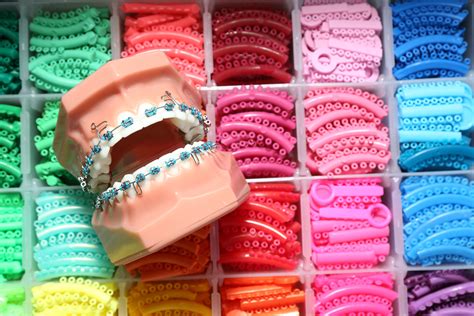 What Color Of Braces Should You Wear Shinagawa Ph