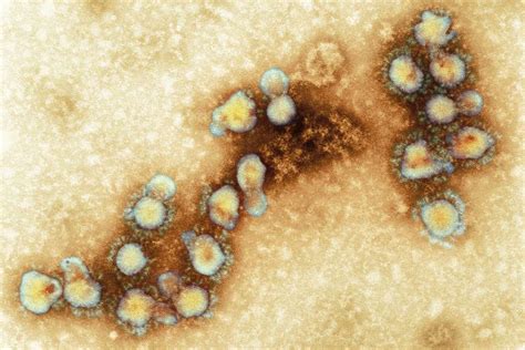 Middle East Respiratory Syndrome Coronavirus Mers Cov Update Gov Uk