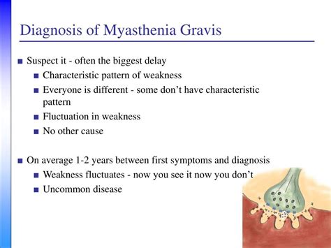 Ppt Myasthenia Gravis A Neurologists Perspective Powerpoint