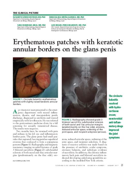 Pdf Erythematous Patches With Keratotic Annular Borders On The Glans