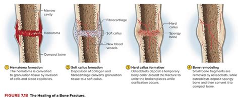 If the pain worsens, i suggest seeing a doctor. How to "bruise a rib" if ribs are bones - Quora
