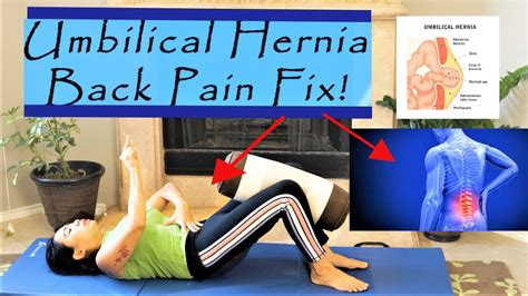 Back Pain And Umbilical Hernia Fix Pilates Follow Along Progression