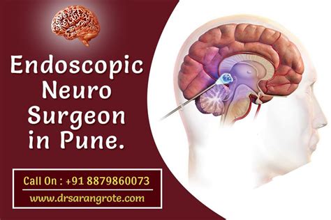 Endoscopic Neurosurgery In Pune Pune Treatment Appointments