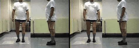 Prosthetic  Find And Share On Giphy