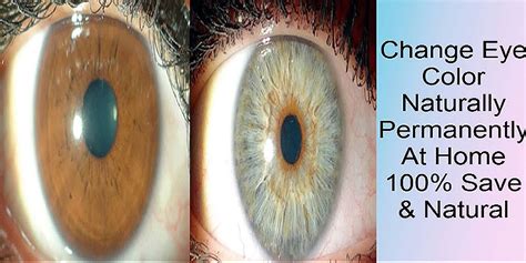 How To Change Your Eyes Color Naturally And Permanently 100 Save The