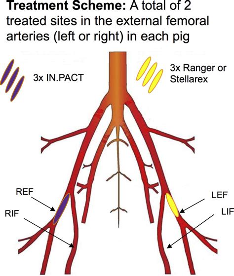 Pdf Successful Treatment Of A Superficial Femoral Artery Images And