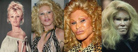 4 Plastic Surgery Cases That Have Gone Extreme Science Times