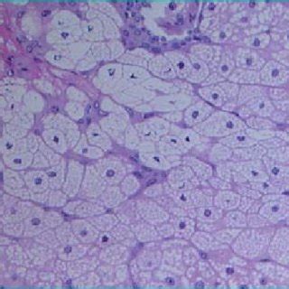 Dermatoscopia di un cuoio capelluto con DS-presenza di ...